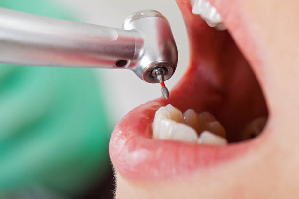 Best Urgent Dental Care in Mked Tree, AR